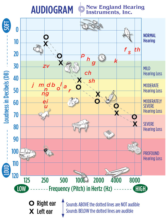 Hearing Loss Chart For Hearing Levels